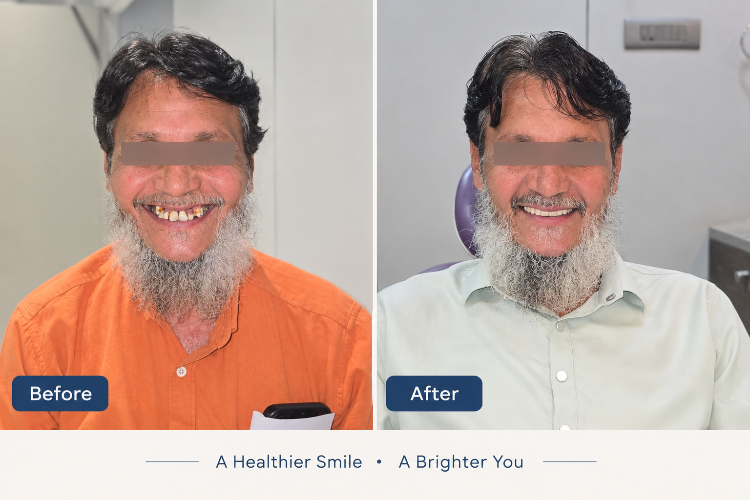Clinic-provided before and after photographs of a patient's smile transformation
